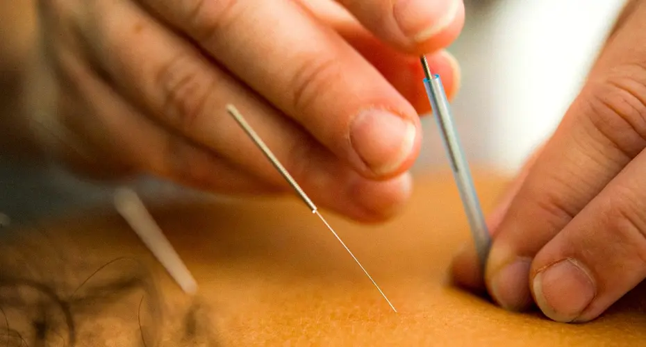 Boghar Education Academy: Advanced Courses in Acupuncture, Naturopathy & Holistic Healing