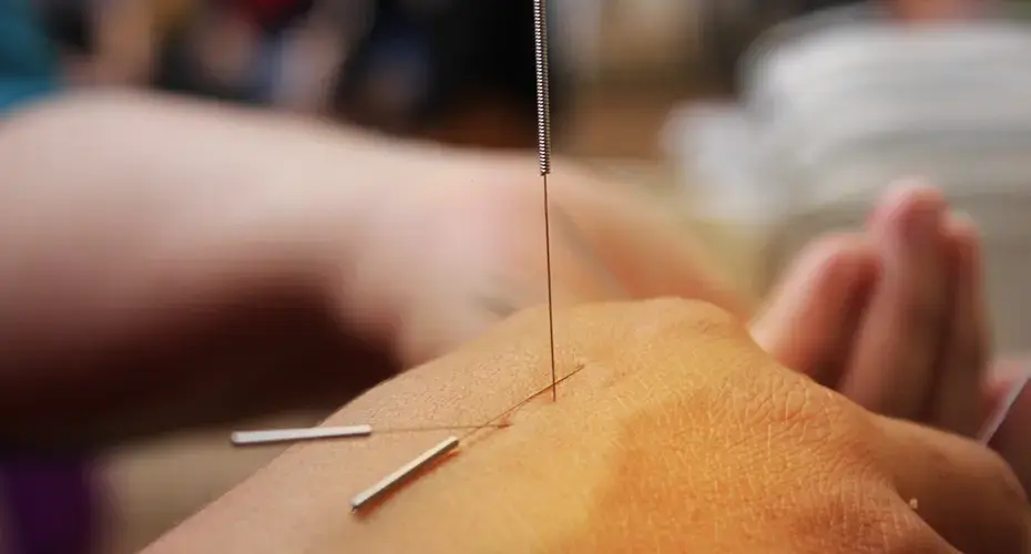 Boghar Education Academy: Advanced Courses in Acupuncture, Naturopathy & Holistic Healing