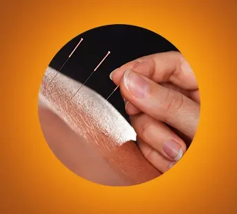 Boghar Education Academy: Advanced Courses in Acupuncture, Naturopathy & Holistic Healing