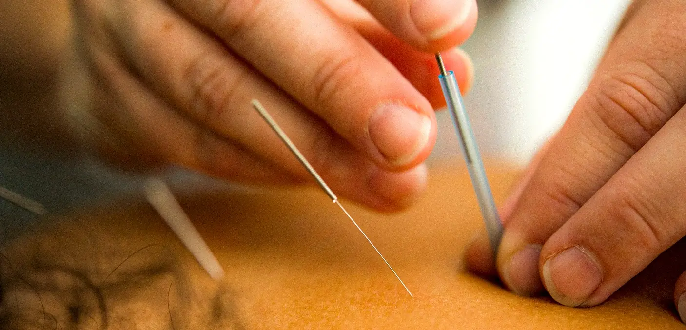 Boghar Education Academy: Advanced Courses in Acupuncture, Naturopathy & Holistic Healing